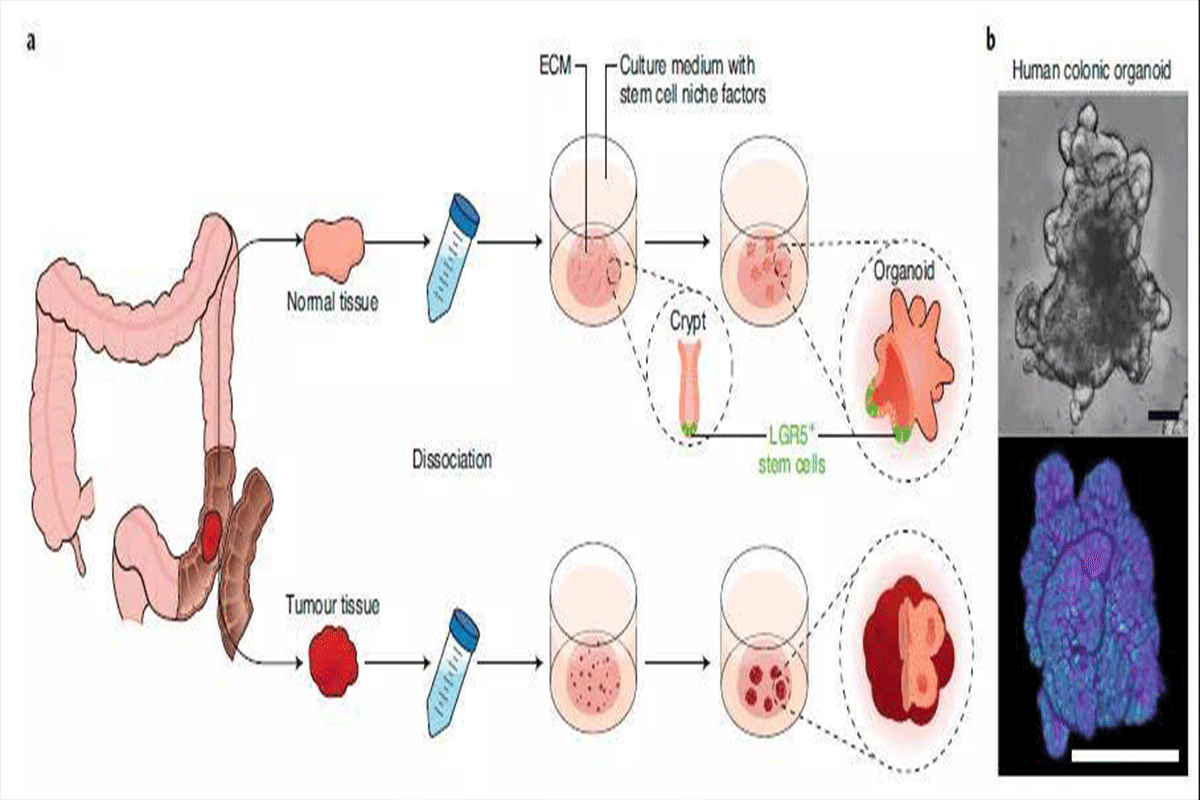 干细胞衍生的类器官可模拟甲状旁腺组织